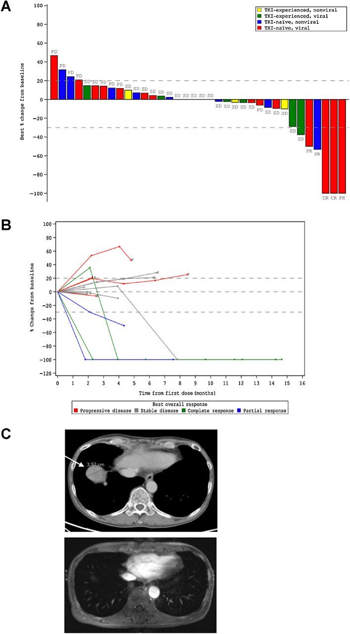 Figure 1. Clinical activity of MTL-CEBPA in advanced HCC patients treated in combination with sorafenib. A, Waterfall plot of patients in phase Ib study showing best percentage (%) change from baseline, with identification of groups that had previously been treated with TKI and those that had HCC of viral etiology. B, Durable responses of patients previously naïve to TKI with HCC of viral etiology. Spider plot in phase Ib patients who had not previously been treated with TKI and had HCC of viral etiology, showing tumor response for target lesions. C, Complete radiologic response of lung metastases following treatment with MTL-CEBPA and sorafenib. Cross-sectional imaging of a patient with baseline imaging on top from June 12, 2018, showing right lung metastases and on bottom from December 31, 2018, showing complete resolution of lung metastases. This patient maintains a complete radiologic response to both liver and lung metastases on last surveillance imaging on March 13, 2020.