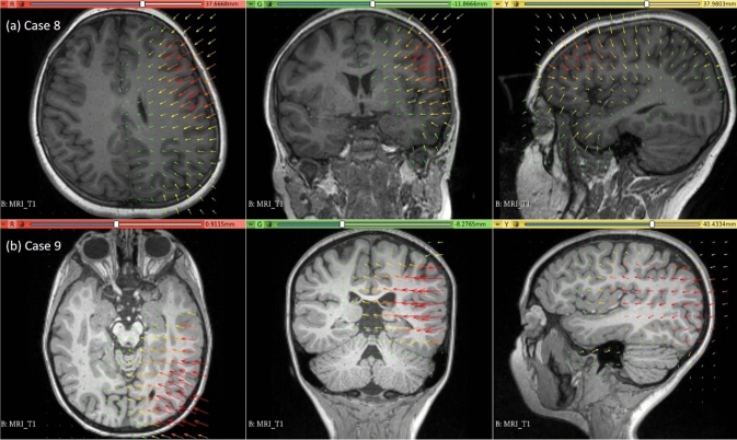 Fig. 11