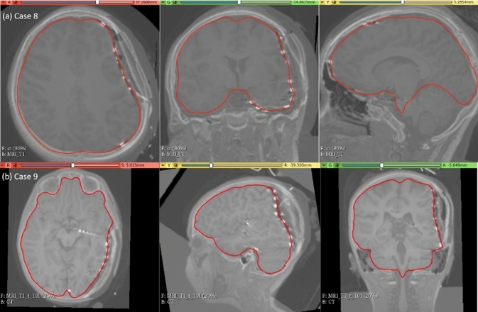 Fig. 13