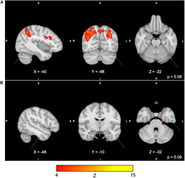 FIGURE 4