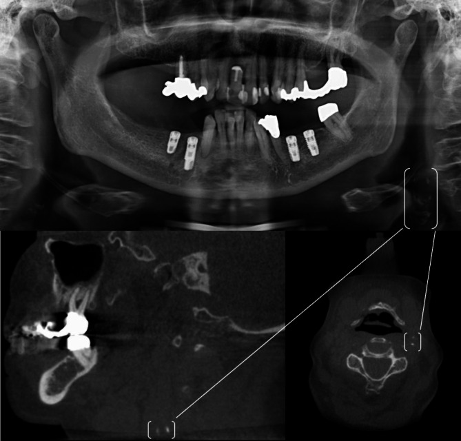 Fig. 3