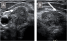 FIGURE 21