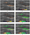 Figure 10