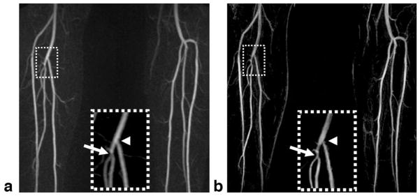 FIG. 9