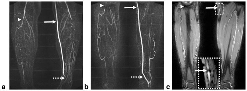 FIG. 10