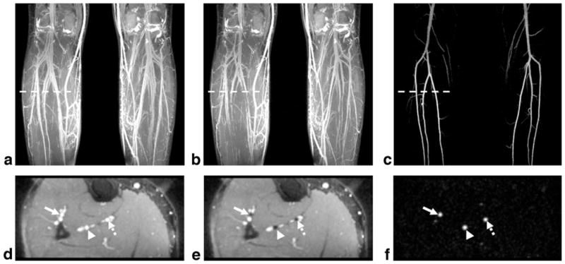 FIG. 5