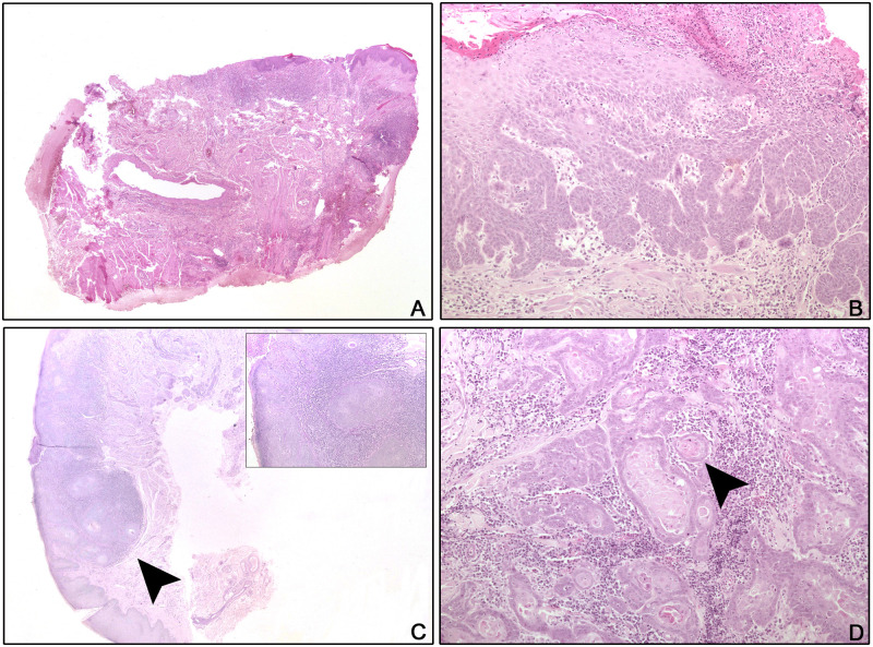 Fig 2