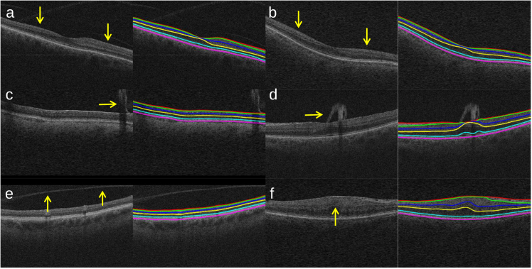 Fig. 9.