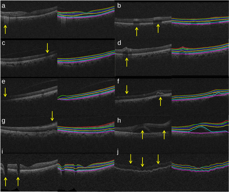 Fig. 8.