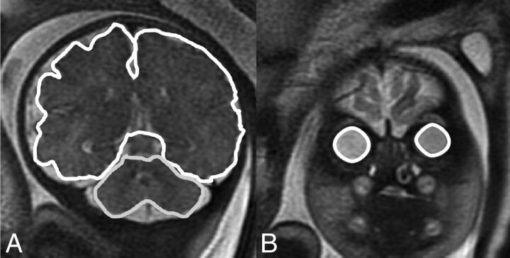 Fig 2.