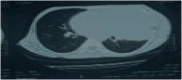 Fig. 2B