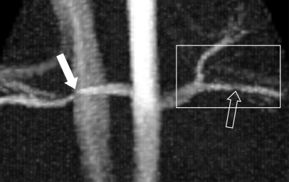 Figure 2a: