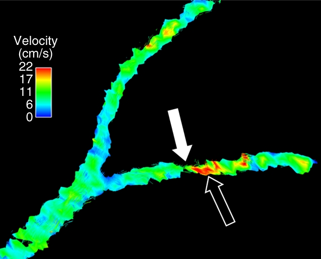 Figure 2b: