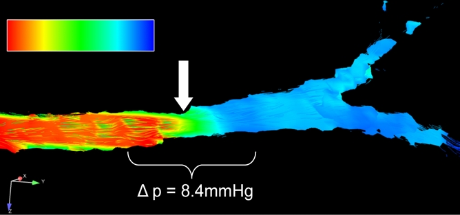 Figure 1d: