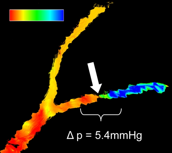 Figure 2c: