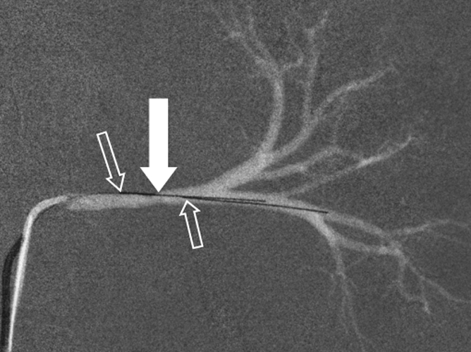 Figure 1a: