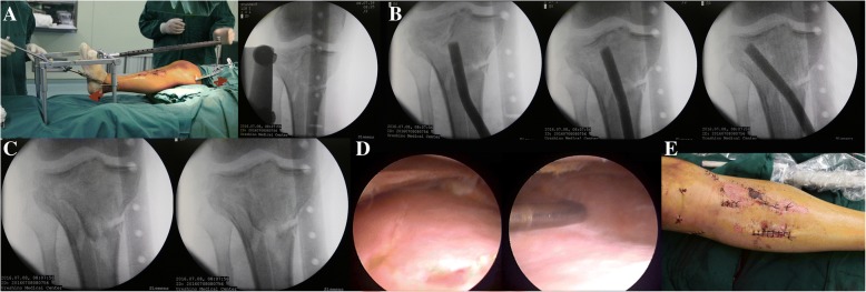 Fig. 4