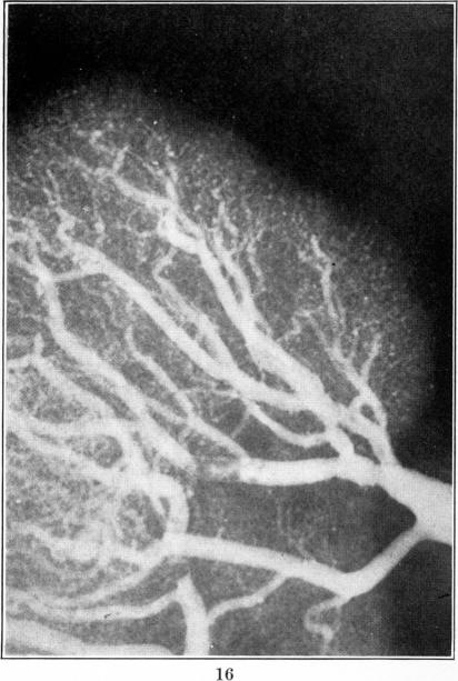 Fig. 16