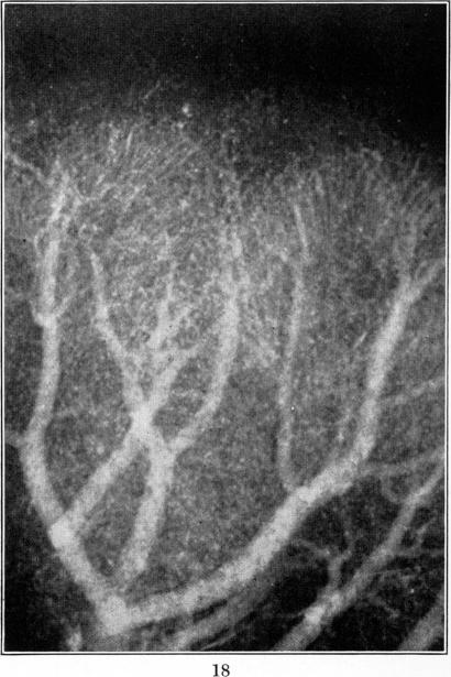 Fig. 18