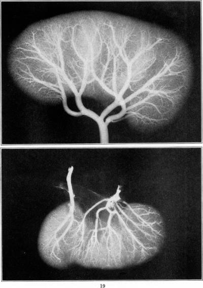 Fig. 19