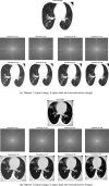 Fig. 11