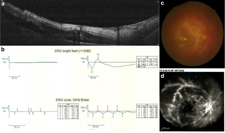 Fig. 1