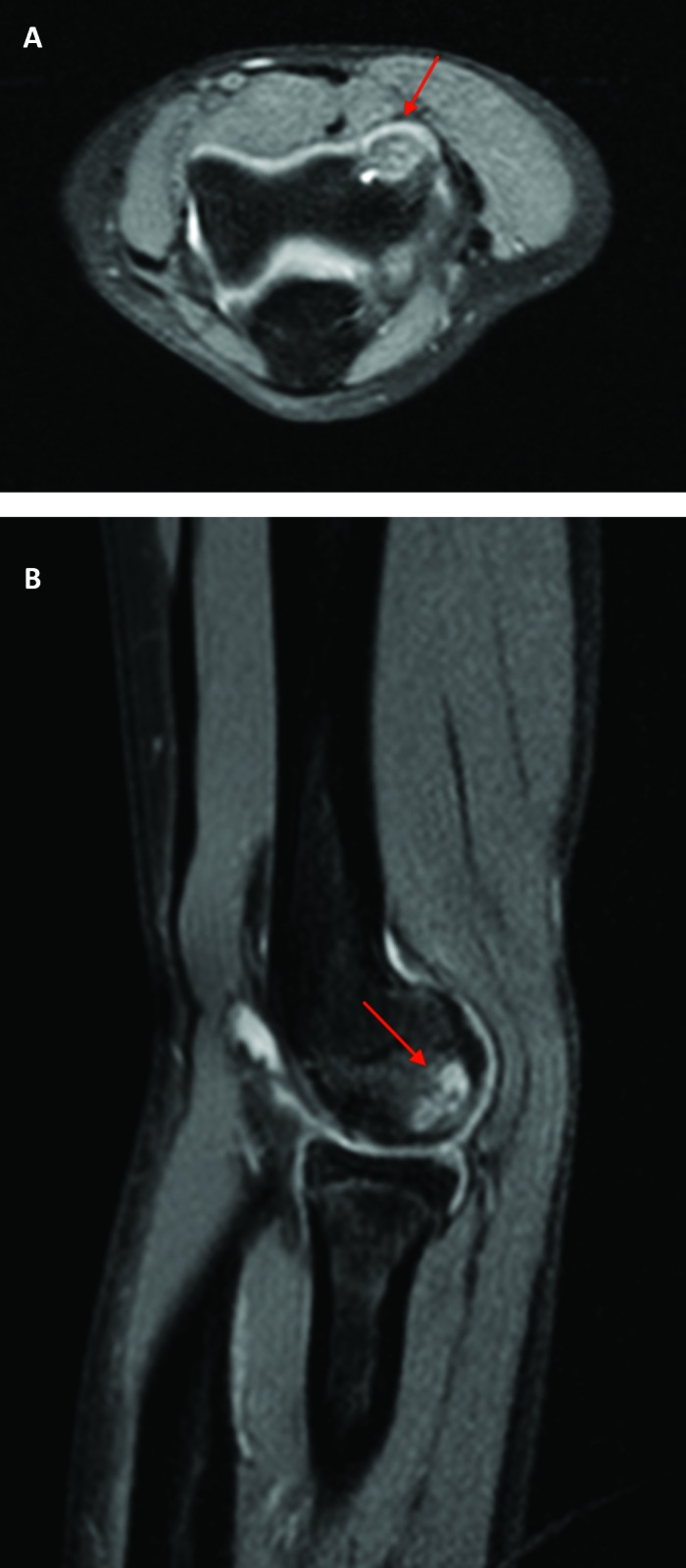 Figure 3a and 3b.