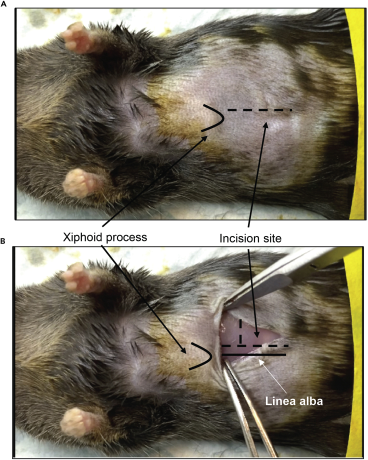 Figure 2