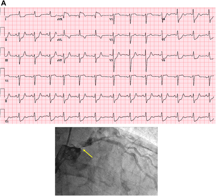 Figure 2