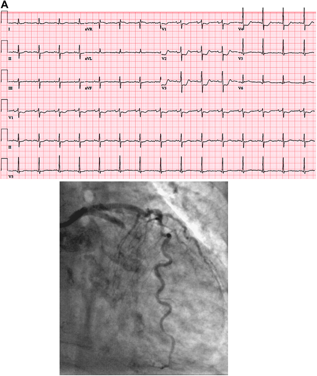 Figure 1