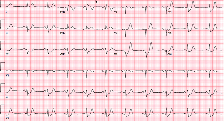 Figure 4