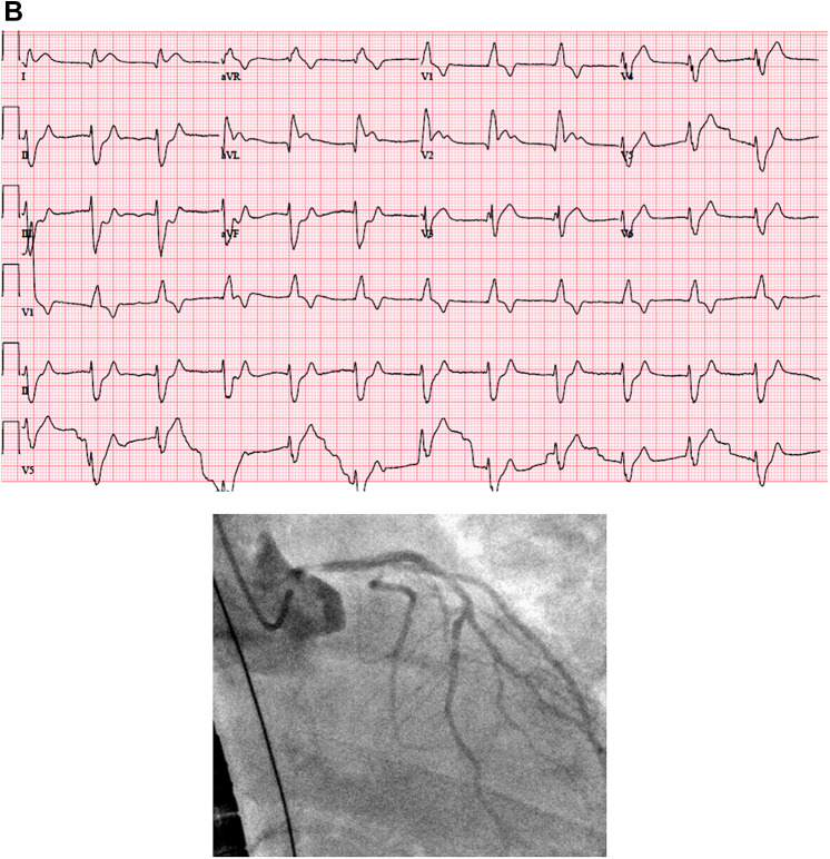 Figure 2