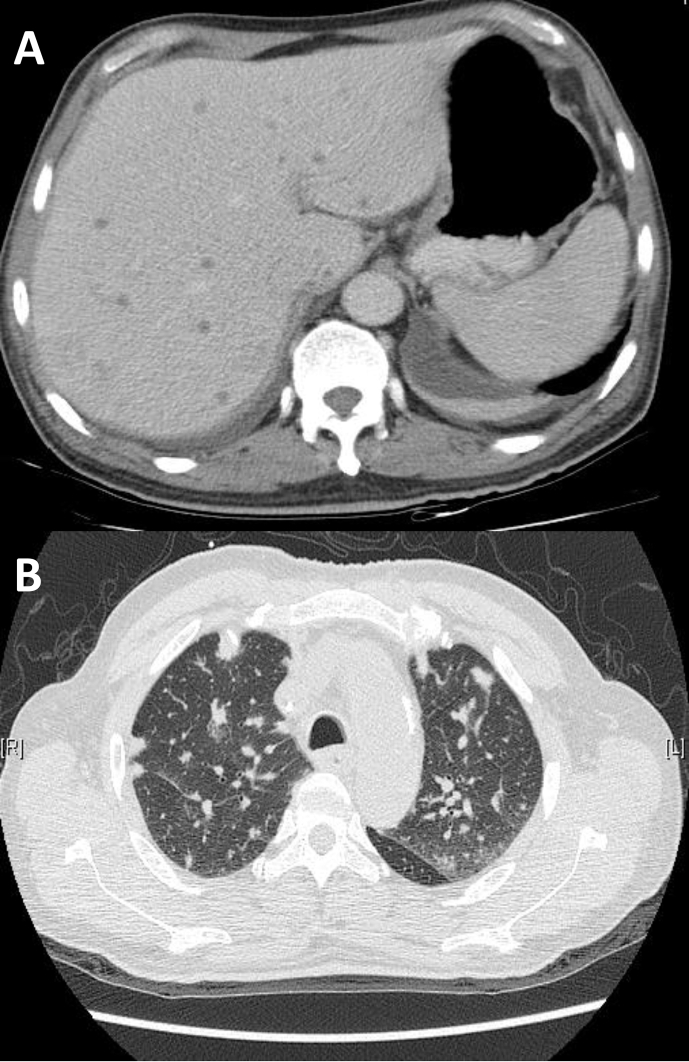 Fig. 1