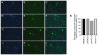 Figure 4. Subcellular localization of overexpressed SPATA3 isoforms in HeLa cells. Cells overexpressing the pEGFP–C3–SPATA3–I1 isoform. (A) Hoechst 33258 staining. (B) GFP signals for overexpression o...
