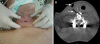 Fig. 2
