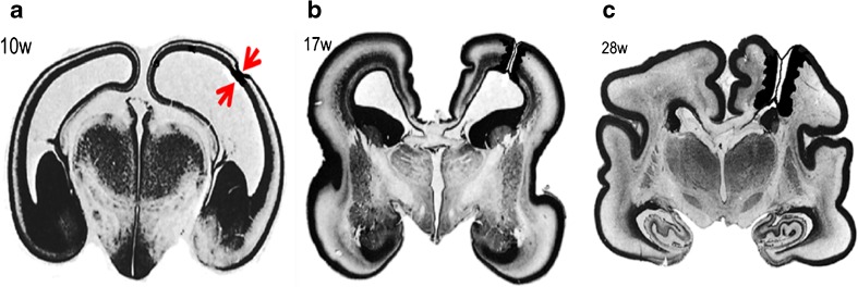 Fig. 12