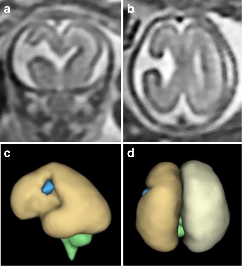 Fig. 11