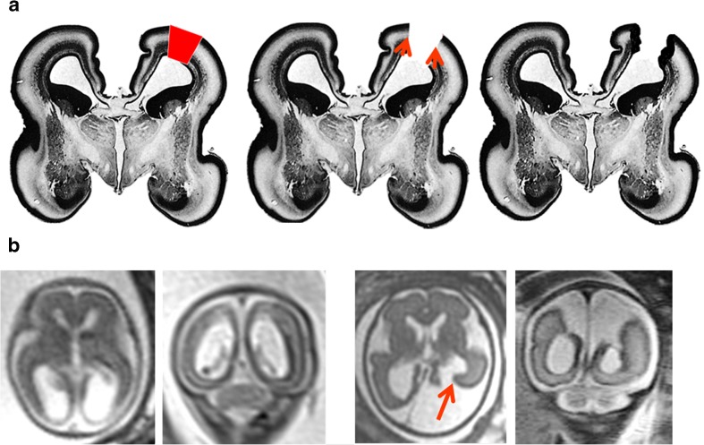 Fig. 13