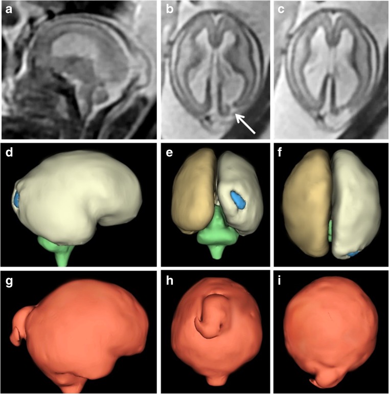 Fig. 10