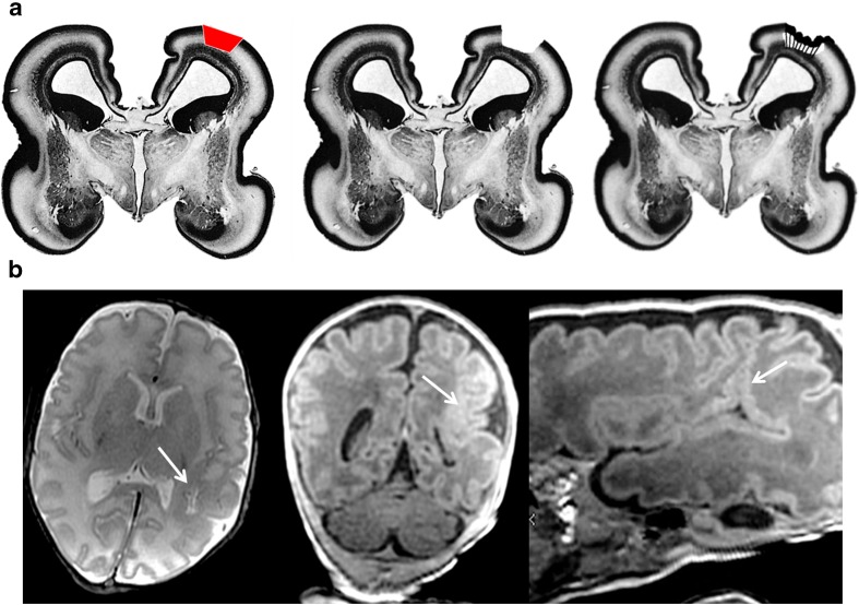 Fig. 14