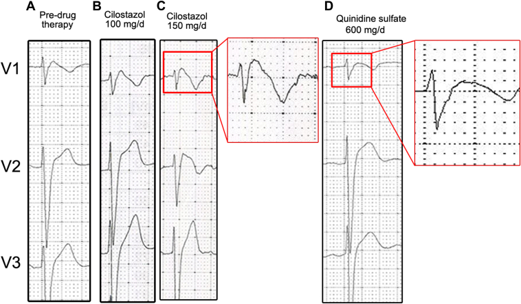 Figure 2