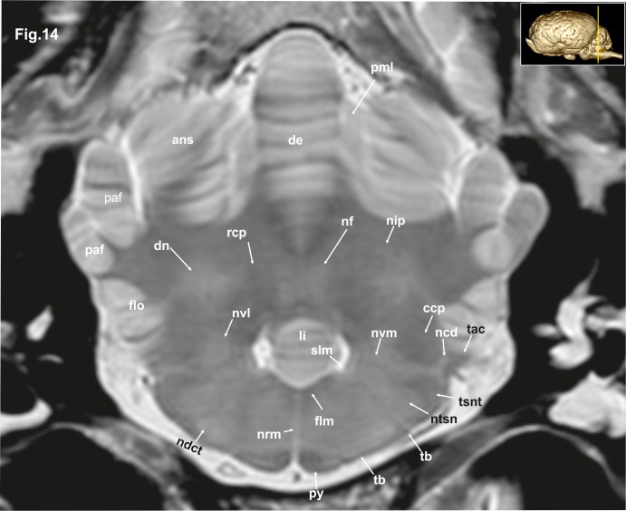 Fig 14