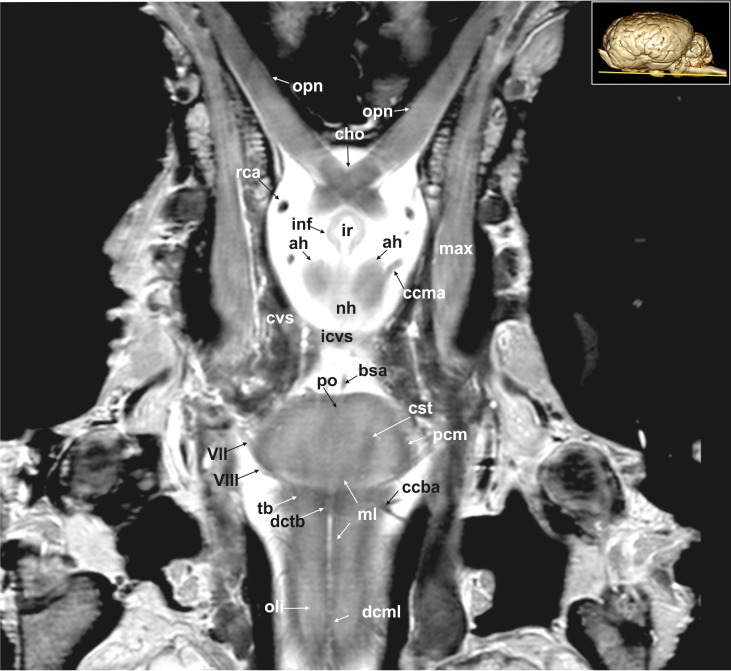 Fig 17