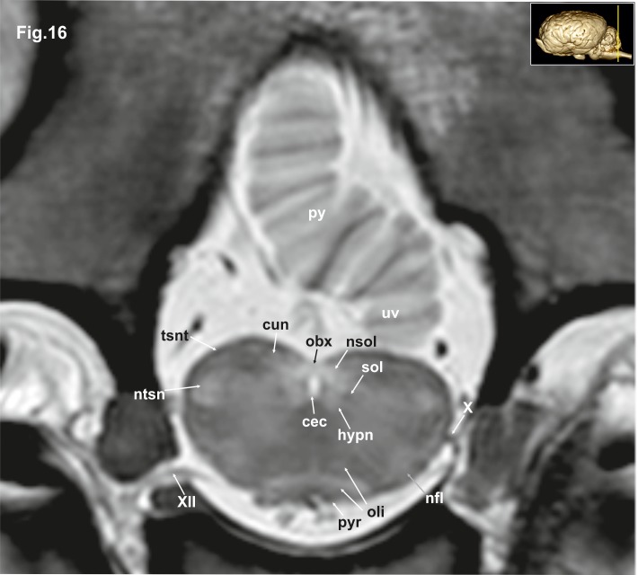 Fig 16