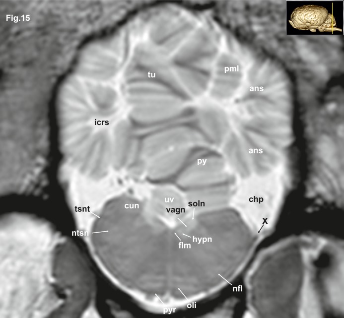 Fig 15