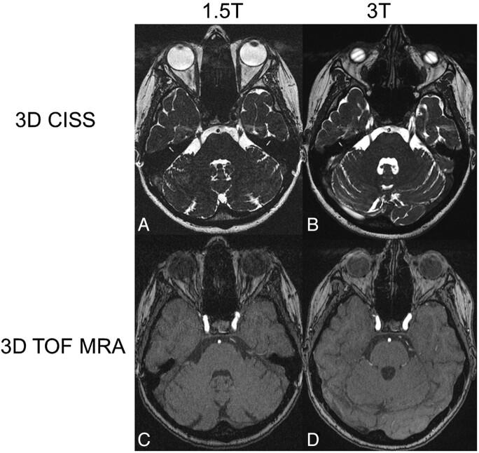 Fig 1.