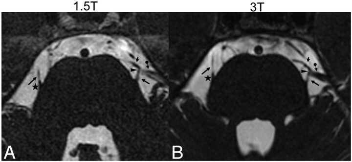 Fig 3.