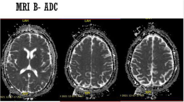 Fig. 2 (abstract P81).