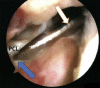 Fig 5