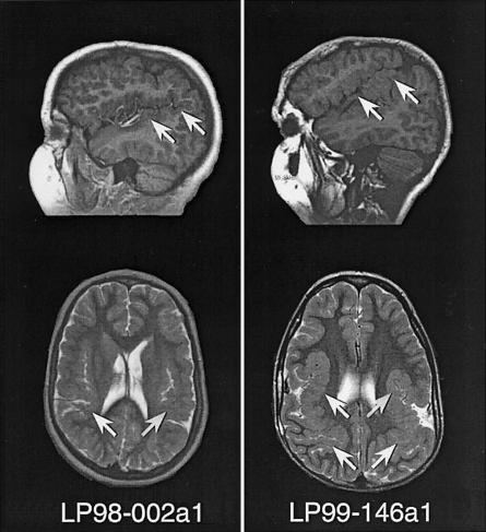 Figure  2